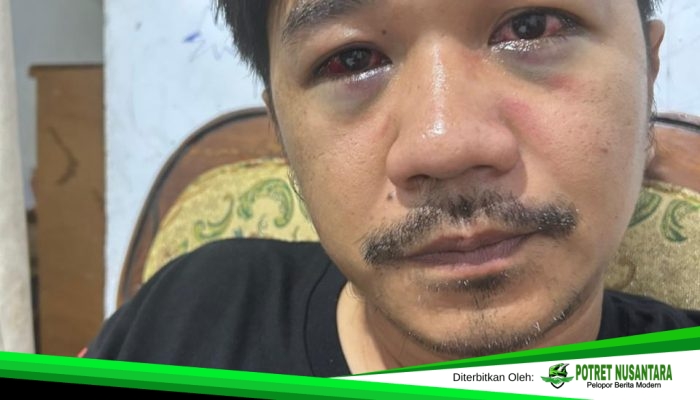 8 Hari Berlalu, Terduga Pelaku Penganiayaan Masih Bebas Berkeliaran, Ada Apa dengan Penanganan Polres Palopo?