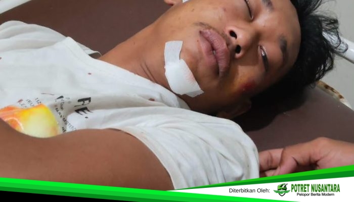 Diduga Dipukuli Oleh Anak Salah Seorang Ketua RT Kelurahan Dangerakko, Korban Desak Polisi Bertindak Cepat